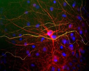 View of mixed neuron/glial cultures stained with Chicken polyclonal antibody to Neurofilament Light BSENC-1390-50 (red) and Rabbit polyclonal antibody to Neurofilament Heavy, phosphorylated BSENR-1388-50 (green).