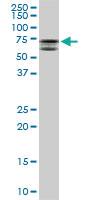 Anti-MTMR2 Mouse Monoclonal Antibody [clone: 4G6]