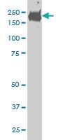 Anti-CDC42BPB Mouse Monoclonal Antibody [clone: 6G3]