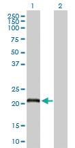 Anti-DCAKD Rabbit Polyclonal Antibody