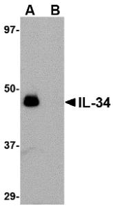 Western blot analysis of IL-34 in human brain tissue lysate with IL-34 antibody at 0.25 &#956;g/mL in (A) the absence and (B) the presence of blocking peptide.