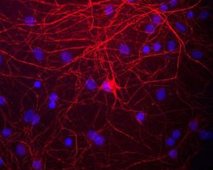 View of mixed neuron/glial cultures stained with Chicken polyclonal antibody to Neurofilament Medium BSENC-1393-50 (red). The Neurofilament Medium (NF-M) protein is assembled into neurofilaments which are found throughout the axons, dendrites and perikarya of these cells.