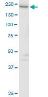 Anti-GAPVD1 Mouse Polyclonal Antibody