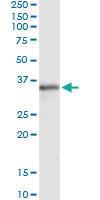 Anti-MSX1 Antibody Pair