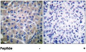 Anti-BCAR1 Rabbit Polyclonal Antibody