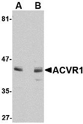 Western blot analysis of ACVR1 in A549 cell lysate with ACVR1 antibody at 1 &#956;g/mL in (A) the absence and (B) the presence of blocking peptide.