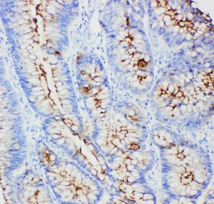 Anti-CEA Mouse Monoclonal Antibody [clone: CEA-9]