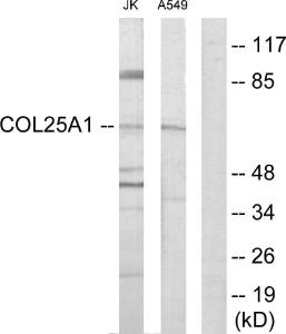 Anti-Collagen XXV alpha1 antibody