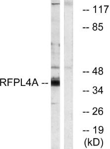 Western blot analysis of lysates from HUVEC cells using Anti-RFPL4A Antibody. The right hand lane represents a negative control, where the antibody is blocked by the immunising peptide.