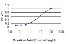 Anti-MTMR2 Mouse Monoclonal Antibody [clone: 4G6]