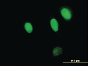 Anti-NPLOC4 (nuclear Protein localization 4 homolog (S. cerevisiae)) Mouse Polyclonal Antibody