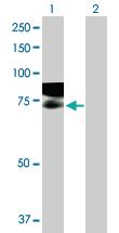 Anti-GAPVD1 Mouse Polyclonal Antibody