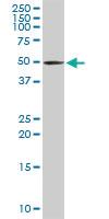 Anti-TRDMT1 Rabbit Polyclonal Antibody