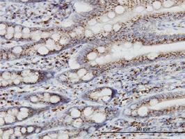 Anti-TGOLN2 Mouse Monoclonal Antibody [clone: 2F11]