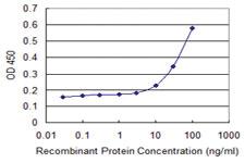 Anti-TTYH1 Mouse Monoclonal Antibody [clone: 4A9]