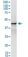 Anti-ADH1C Polyclonal Antibody Pair