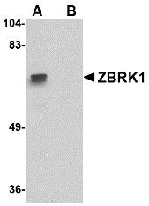 Western blot analysis of ZBRK1 in A-20 lysate with ZBRK1 antibody at 1 &#956;g/mL in (A) the absence and (B) the presence of blocking peptide.