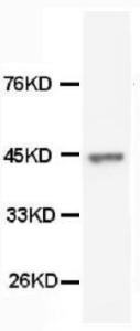 Anti-Cytokeratin Peptide 18 Mouse Monoclonal Antibody [clone: CK-18]