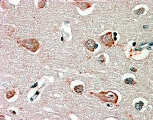 Anti-GABRB3 Antibody (A82974) (2.5 µg/ml) staining of paraffin embedded Human Cortex. Steamed antigen retrieval with citrate buffer pH 6, AP-staining