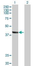 Anti-TRDMT1 Rabbit Polyclonal Antibody