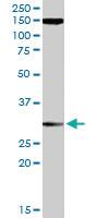 Anti-SUPT16H Goat Polyclonal Antibody