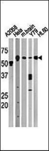 Anti-BECN1 Rabbit Polyclonal Antibody (Biotin)