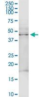 Anti-TRDMT1 Rabbit Polyclonal Antibody