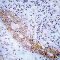 Anti-FLT3 Rabbit Polyclonal Antibody