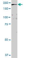 Anti-GAPVD1 Mouse Polyclonal Antibody