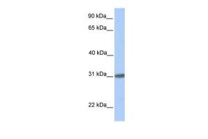 Anti-C7orf61 Rabbit Polyclonal Antibody