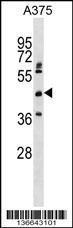 Anti-ASPHD2 Rabbit Polyclonal Antibody (AP (Alkaline Phosphatase))