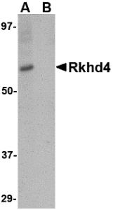 Western blot analysis of Rkhd4 in SK-N-SH cell lysate with Rkhd4 antibody at 1 &#956;g/mL in (A) the absence and (B) the presence of blocking peptide.