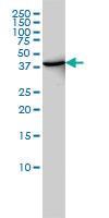 Anti-TRDMT1 Mouse Monoclonal Antibody [clone: 1E12]