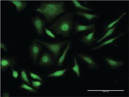 Anti-PRPF4B Mouse Monoclonal Antibody [clone: 3E10]