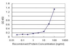 Anti-KHK Antibody Pair