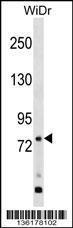 Anti-GPR149 Rabbit Polyclonal Antibody (APC (Allophycocyanin))