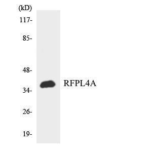 Western blot analysis of the lysates from HeLa cells using Anti-RFPL4A Antibody