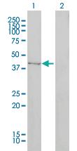 Anti-TRDMT1 Mouse Monoclonal Antibody [clone: 1E12]