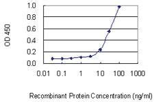 Anti-PRPF4B Mouse Monoclonal Antibody [clone: 3E10]