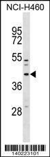 Anti-MFF Rabbit Polyclonal Antibody (PE (Phycoerythrin))