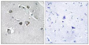 Immunohistochemical analysis of paraffin-embedded human brain tissue using Anti-Collagen XI alpha2 Antibody The right hand panel represents a negative control, where the antibody was pre-incubated with the immunising peptide