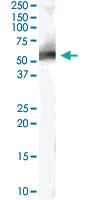 Anti-MDM2 Goat Polyclonal Antibody