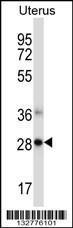 Anti-NDFIP1 Rabbit Polyclonal Antibody