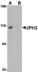 Western blot analysis of JPH3 in Daudi cell lysate with JPH3 antibody at 1 &#956;g/mL in (A) the absence and (B) the presence of blocking peptide.