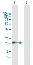 Anti-MECOM Mouse Polyclonal Antibody