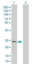 Anti-AICDA Rabbit Polyclonal Antibody