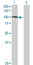 Anti-TRPC4AP Mouse Polyclonal Antibody