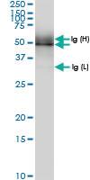 Anti-PUS1 Rabbit Polyclonal Antibody