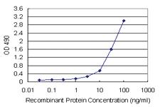 Anti-KHK Antibody Pair