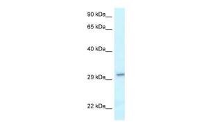 Anti-VTI1B Rabbit Polyclonal Antibody